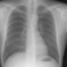 Röntgen Thorax